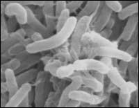 Vibrio cholerae Vibrio cholerae